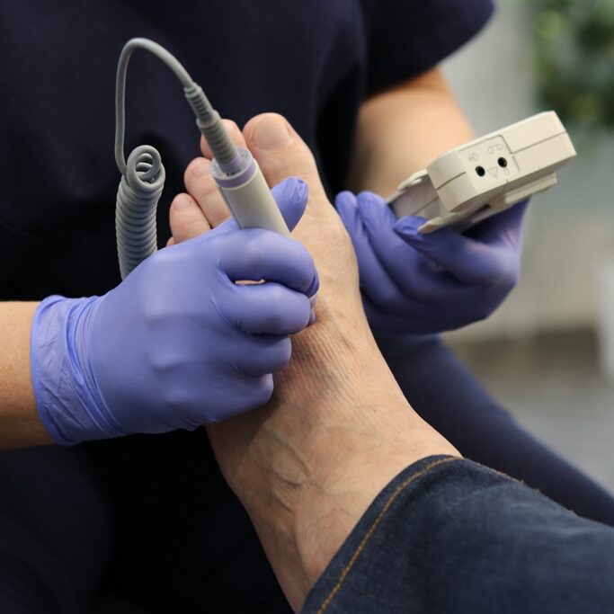 Podiatrist using a doppler at LR Podiatry, Sheffield